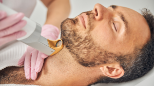 man getting beard line laser hair removal