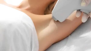 Laser Hair Removal for Armpits